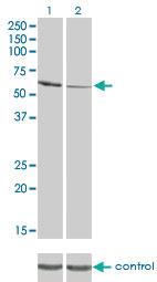 Anti-RIOK3 Mouse Monoclonal Antibody [clone: 3G11]