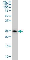 Anti-DCXR Mouse Monoclonal Antibody [clone: 6A6]