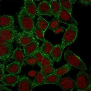 Anti-Moesin antibody