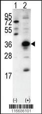 Anti-SNAI1 Rabbit Polyclonal Antibody