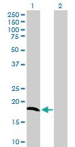 Anti-NDUFA8 Mouse Polyclonal Antibody