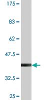 Anti-AKAP12 Mouse Monoclonal Antibody [clone: 3C3]