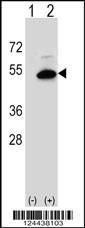 Anti-SGMS2 Rabbit Polyclonal Antibody (APC (Allophycocyanin))