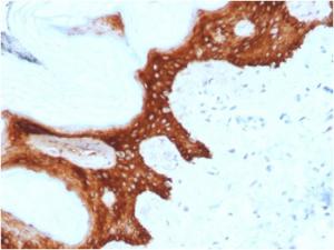 Immunohistochemical analysis of formalin-fixed, paraffin-embedded human skin using Anti-14-3-3 Sigma Antibody [CPTC-SFN-2]