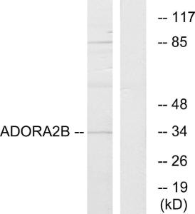 Western blot analysis of lysates from Jurkat cells using Anti-ADORA2B Antibody The right hand lane represents a negative control, where the antibody is blocked by the immunising peptide