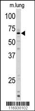 Anti-CYP1A1 Rabbit Polyclonal Antibody