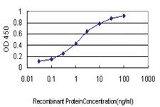 Anti-RIOK3 Mouse Monoclonal Antibody [clone: 3G11]