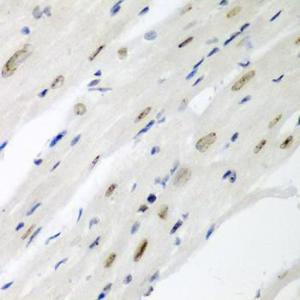 Immunohistochemistry analysis of paraffin-embedded mouse heart using Anti-Cdc27 Antibody (A11494) at a dilution of 1:200 (40x lens). Perform microwave antigen retrieval with 10 mM PBS buffer pH 7.2 before commencing with IHC staining protocol.