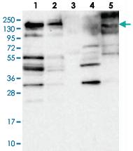 Anti-SH3PXD2A Rabbit Polyclonal Antibody