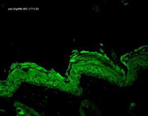 Immunohistochemistry analysis of mouse backskin, fixed in Bouin's fixative solution. The Primary Antibody used was Anti-HSP90 beta Antibody (A304780) at 1:100 for 1 hour at room temperature.