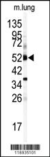 Anti-CYP1A1 Rabbit Polyclonal Antibody