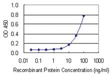 Anti-PRKCSH Mouse Monoclonal Antibody [clone: 3H7]