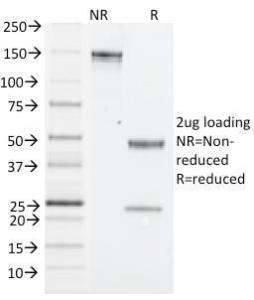 SDS-PAGE analysis of Anti-NK1.1 Antibody [PK136] under non-reduced and reduced conditions; showing intact IgG and intact heavy and light chains, respectively. SDS-PAGE analysis confirms the integrity and purity of the antibody