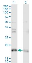 Anti-NDUFA8 Mouse Monoclonal Antibody [clone: 2E10]