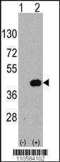 Anti-WIF1 Rabbit Polyclonal Antibody (APC (Allophycocyanin))