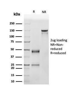 SDS-PAGE analysis of Anti-p53 Antibody [SPM514] under non-reduced and reduced conditions; showing intact IgG and intact heavy and light chains, respectively. SDS-PAGE analysis confirms the integrity and purity of the antibody.