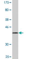 Anti-ZP2 Mouse Monoclonal Antibody [clone: 2B9]