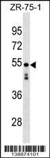 Anti-KT81L Rabbit Polyclonal Antibody (AP (Alkaline Phosphatase))