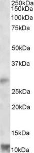 Anti-RNF7 Antibody (A82681) (1 µg/ml) staining of Human Heart lysate (35 µg protein in RIPA buffer). Primary incubation was 1 hour. Detected by chemiluminescence