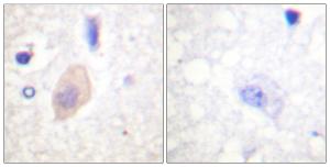 Immunohistochemical analysis of paraffin-embedded human brain using Anti-CDC25B (phospho Ser353) Antibody. The right hand panel represents a negative control, where the antibody was pre-incubated with the immunising peptide.