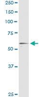 Anti-RXRA Antibody Pair