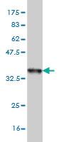 Anti-FOXF2 Mouse Monoclonal Antibody [clone: 3F5]