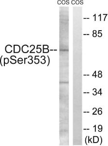 Western blot analysis of lysates from COS7 cells treated with etoposide 25uM 24h using Anti-CDC25B (phospho Ser353) Antibody. The right hand lane represents a negative control, where the antibody is blocked by the immunising peptide.