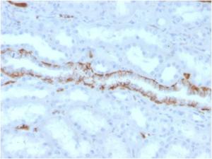 Immunohistochemical analysis of formalin-fixed, paraffin-embedded human kidney using Anti-FABP1 Antibody [FABP1/3486]