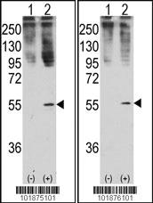 Anti-GDF11 Rabbit Polyclonal Antibody