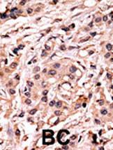 Anti-TP53 Rabbit Polyclonal Antibody (PE (Phycoerythrin))