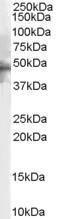 Anti-HTR1B antibody