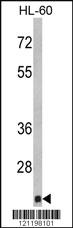 Anti-CBFB Rabbit Polyclonal Antibody