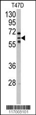 Anti-CYP2C8 Rabbit Polyclonal Antibody