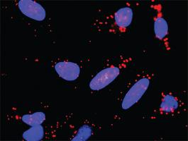 Anti-PGF + VEGFA Antibody Pair