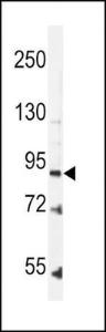 Anti-LEPR Rabbit Polyclonal Antibody (HRP (Horseradish Peroxidase))