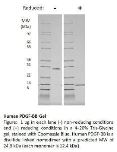 Human recombinant PDGF-BB (from <i>E. coli</i>)