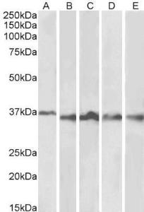 Antibody anti-AURORA B 100 µg