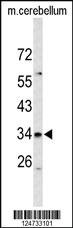 Anti-S39A3 Rabbit Polyclonal Antibody