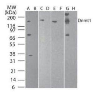 Anti-DNMT1 Mouse Monoclonal Antibody [clone: 60B1220.1]