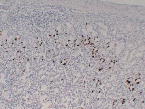 Immunohistochemical analysis of paraffin-embedded human Stomach using Anti-Gastrin Antibody