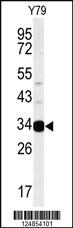 Anti-AIG1 Rabbit Polyclonal Antibody