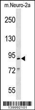 Anti-MCM2 Rabbit Polyclonal Antibody (AP (Alkaline Phosphatase))