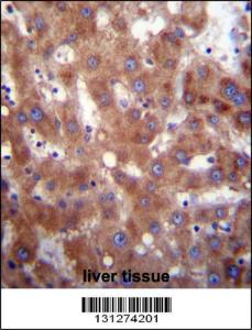 Anti-HSD17B4 Rabbit Polyclonal Antibody (FITC (Fluorescein Isothiocyanate))