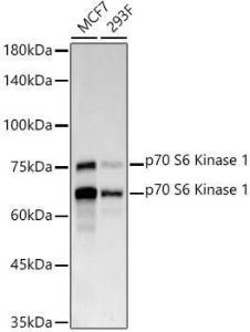 Western blot analysis of various lysates, using Anti-S6K1 Antibody [ARC57223] (A307700) at 1:1000 dilution