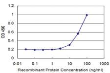 Anti-SMAD6 Mouse Monoclonal Antibody [clone: 2E4]