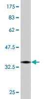 Anti-TRIB2 Mouse Monoclonal Antibody [clone: 1B1]