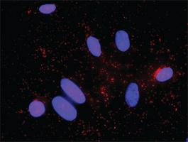 Anti-AKT1 + CDKN1B Antibody Pair