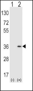 Anti-SULT1A1 Rabbit Polyclonal Antibody (APC (Allophycocyanin))