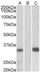 Antibody anti-CSEN A82682-100 100 µg