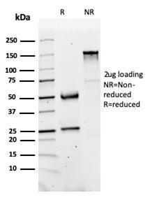 SDS-PAGE analysis of Anti-FABP1 Antibody [FABP1/3486] under non-reduced and reduced conditions; showing intact IgG and intact heavy and light chains, respectively. SDS-PAGE analysis confirms the integrity and purity of the antibody